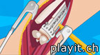 Arm Surgery 2